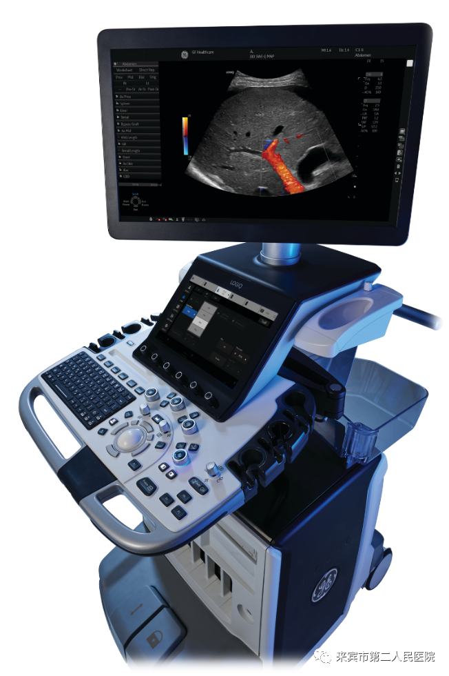 彩超logiq怎么读来宾市第二人民医院引进进口GE彩超，影像更清晰_https://www.jmylbn.com_新闻资讯_第3张