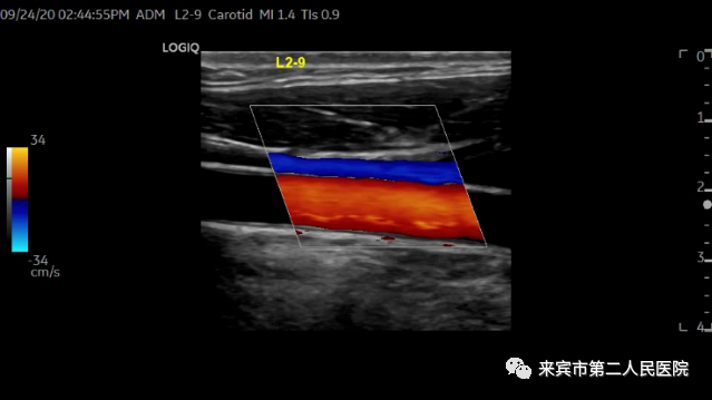 彩超logiq怎么读来宾市第二人民医院引进进口GE彩超，影像更清晰_https://www.jmylbn.com_新闻资讯_第5张
