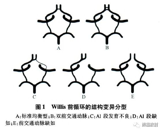 willis环的最细解剖 最全变异