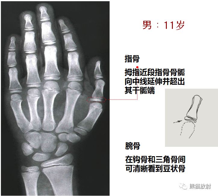 (方便随时对照)_医学界-助力医生临床决策和职业成长