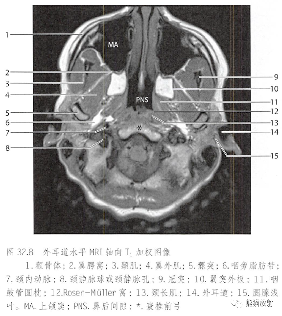 解剖丨颞下窝,翼腭窝,颞下颌关节_医学界-助力医生临床决策和职业成长