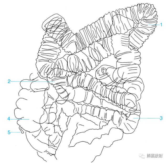 空肠手绘图图片