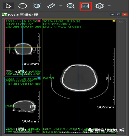 医学胶片怎么做医院再也不用一人拎“一袋”——清水县人民医院成功开通“云胶片”服务_https://www.jmylbn.com_新闻资讯_第8张