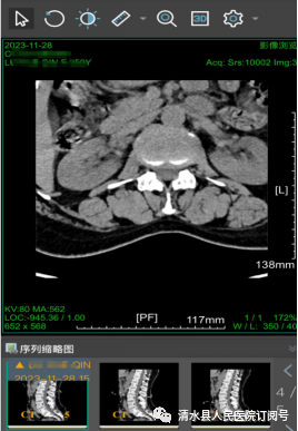 医学胶片怎么做医院再也不用一人拎“一袋”——清水县人民医院成功开通“云胶片”服务_https://www.jmylbn.com_新闻资讯_第5张