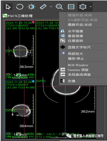 医学胶片怎么做医院再也不用一人拎“一袋”——清水县人民医院成功开通“云胶片”服务_https://www.jmylbn.com_新闻资讯_第9张