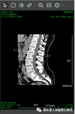 医学胶片怎么做医院再也不用一人拎“一袋”——清水县人民医院成功开通“云胶片”服务_https://www.jmylbn.com_新闻资讯_第6张