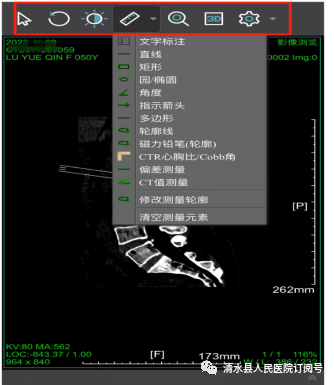 医学胶片怎么做医院再也不用一人拎“一袋”——清水县人民医院成功开通“云胶片”服务_https://www.jmylbn.com_新闻资讯_第7张
