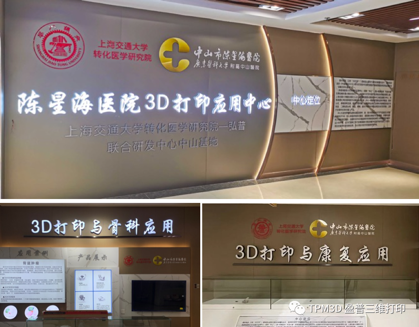 3D打印脊柱侧弯矫形器的图1