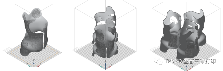 3D打印脊柱侧弯矫形器的图11
