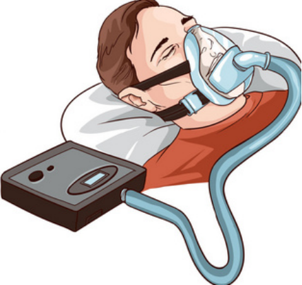 吸氧管怎么消毒科普 ｜ 呼吸疾病的家庭护理设备的使用和消毒-第121期_https://www.jmylbn.com_新闻资讯_第23张