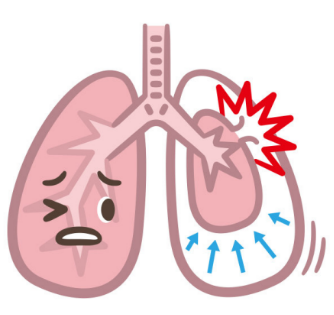 吸氧管怎么消毒科普 ｜ 呼吸疾病的家庭护理设备的使用和消毒-第121期_https://www.jmylbn.com_新闻资讯_第12张