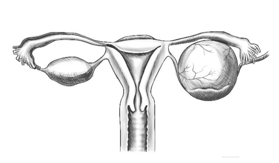 微乔线是什么从妇产科四类常见手术，一窥倒刺线的“神奇”助力_https://www.jmylbn.com_新闻资讯_第5张