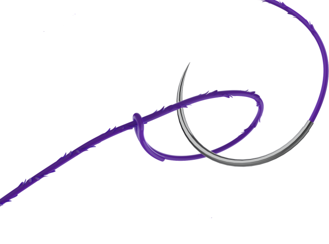 倒刺线怎么缝合泌尿外科微创时代，看倒刺线如何大显身手_https://www.jmylbn.com_新闻资讯_第1张