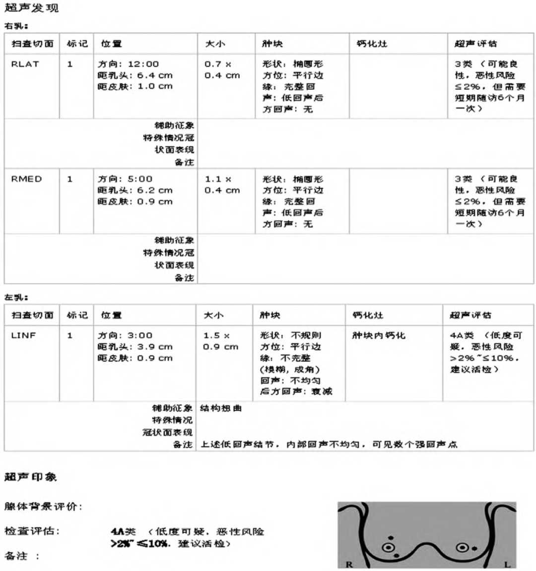 什么是超声容积探头自动乳腺容积超声技术专家共识（2022版）重点摘要_https://www.jmylbn.com_新闻资讯_第19张