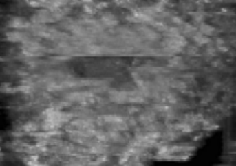 什么是超声容积探头自动乳腺容积超声技术专家共识（2022版）重点摘要_https://www.jmylbn.com_新闻资讯_第9张