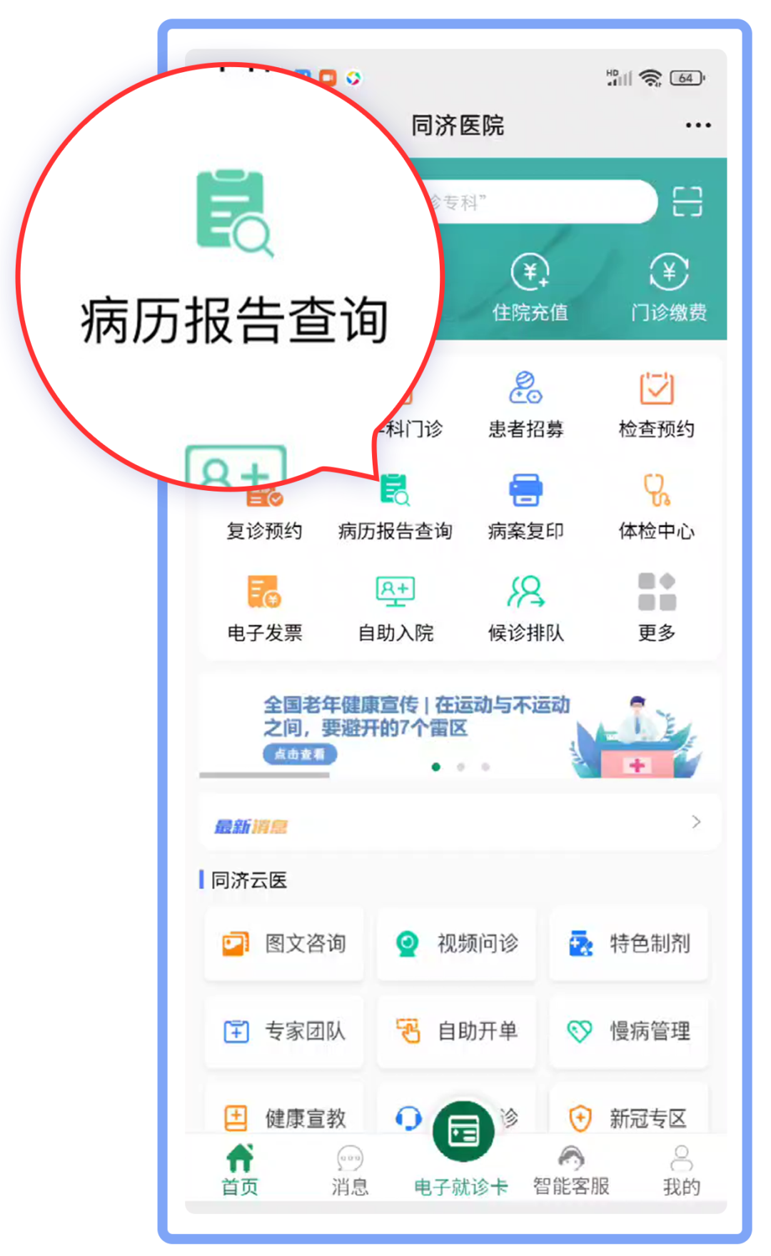 怎么自助取胶片医院【收藏】医学检查“云胶片”上线！无需取片，报告随时随地看！_https://www.jmylbn.com_新闻资讯_第6张