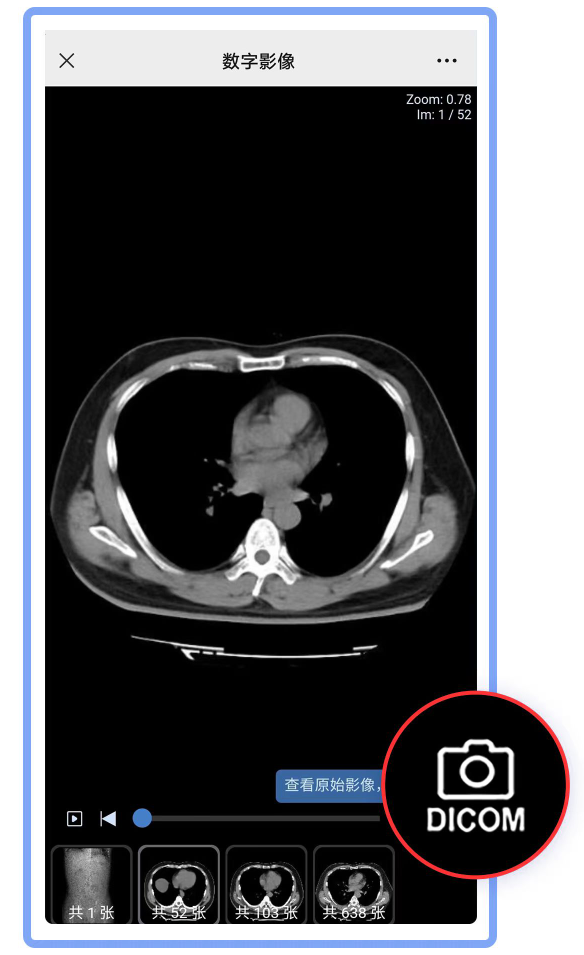怎么自助取胶片医院【收藏】医学检查“云胶片”上线！无需取片，报告随时随地看！_https://www.jmylbn.com_新闻资讯_第1张