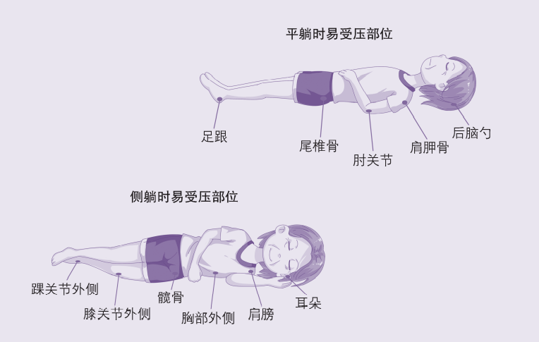 性敷料是什么压力性损伤的临床分期及措施_https://www.jmylbn.com_新闻资讯_第5张