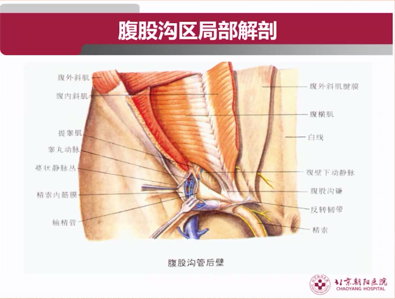 s拉钩怎么用拉钩好几年，还是搞不懂腹股沟区的解剖层次？_https://www.jmylbn.com_新闻资讯_第3张