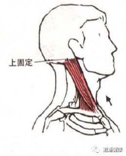 你有乌龟脖吗 那就要看重s C M 胸锁乳突肌 逍遥健康 微信公众号文章阅读 Wemp