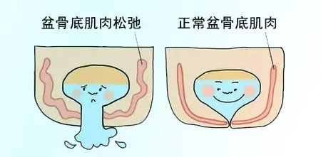 尿道张力过强怎么回事【新技术】我院成功开展经闭孔无张力尿道中段悬吊术_https://www.jmylbn.com_新闻资讯_第9张