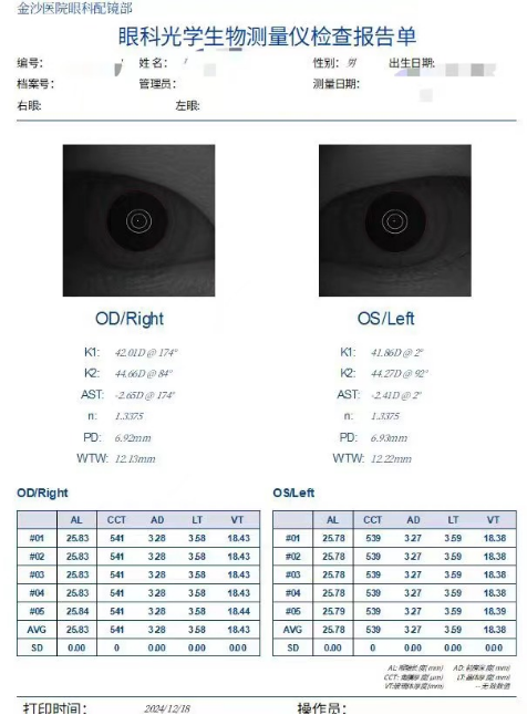 眼科生物测量仪怎么看近视防控必备—生物测量仪（查眼轴）怎么用？_https://www.jmylbn.com_新闻资讯_第1张