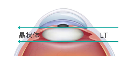 眼科生物测量仪怎么看近视防控必备—生物测量仪（查眼轴）怎么用？_https://www.jmylbn.com_新闻资讯_第4张
