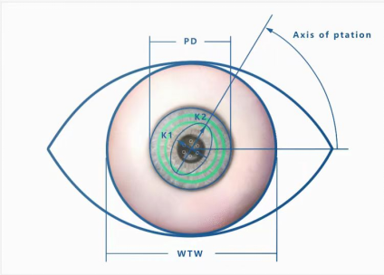 眼科生物测量仪怎么看近视防控必备—生物测量仪（查眼轴）怎么用？_https://www.jmylbn.com_新闻资讯_第5张