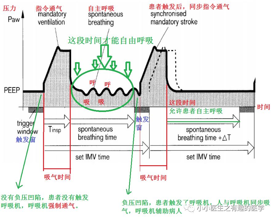 呼吸机ac是什么意思呼吸机：SIMV与AC模式的区别，不讲区别的都是耍流氓_https://www.jmylbn.com_新闻资讯_第6张