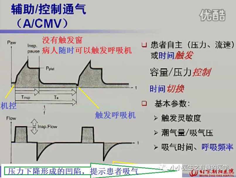 呼吸机ac是什么意思呼吸机：SIMV与AC模式的区别，不讲区别的都是耍流氓_https://www.jmylbn.com_新闻资讯_第9张