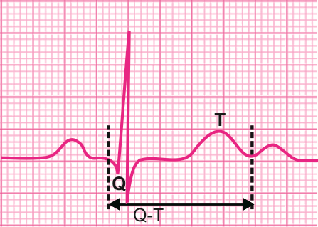 心电图纸怎么看心电图纸上跳动的线条，你了解多少？_https://www.jmylbn.com_新闻资讯_第17张