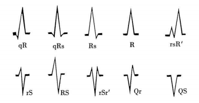 心电图纸怎么看心电图纸上跳动的线条，你了解多少？_https://www.jmylbn.com_新闻资讯_第7张
