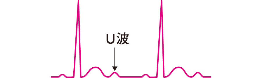 心电图纸怎么看心电图纸上跳动的线条，你了解多少？_https://www.jmylbn.com_新闻资讯_第19张