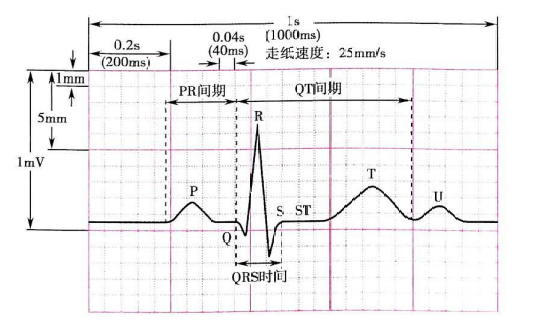 心电图纸怎么看心电图纸上跳动的线条，你了解多少？_https://www.jmylbn.com_新闻资讯_第2张