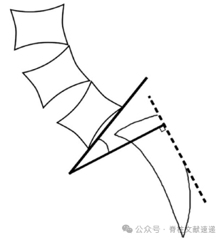 重度腰椎滑脱的手术技巧