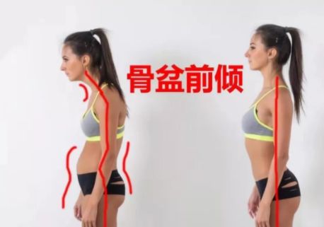 【产后瑜伽】有一种 ‘假翘臀’ 叫骨盆前倾！一组动作还你真翘