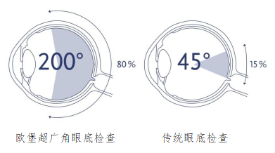 怎么看眼底相机【眼科中心】尼康超广角眼底相机——开启眼病诊疗新视界_https://www.jmylbn.com_新闻资讯_第5张