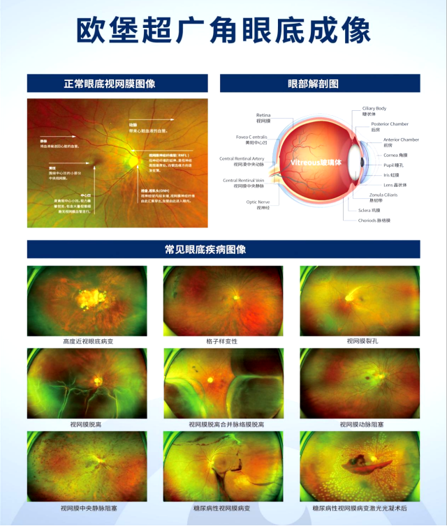 怎么看眼底相机【眼科中心】尼康超广角眼底相机——开启眼病诊疗新视界_https://www.jmylbn.com_新闻资讯_第8张