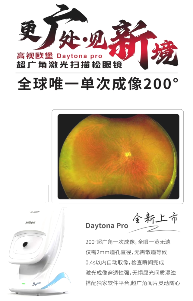 怎么看眼底相机【眼科中心】尼康超广角眼底相机——开启眼病诊疗新视界_https://www.jmylbn.com_新闻资讯_第2张