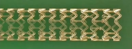 什么是外周支架CX 2023 BVS／DRS专题｜Efemoral Ⅰ研究更新——西罗莫司涂层球扩式生物可吸收支架用于股腘动脉疾病_https://www.jmylbn.com_新闻资讯_第4张