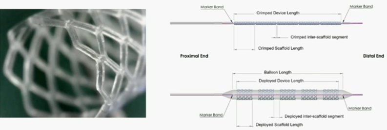什么是外周支架CX 2023 BVS／DRS专题｜Efemoral Ⅰ研究更新——西罗莫司涂层球扩式生物可吸收支架用于股腘动脉疾病_https://www.jmylbn.com_新闻资讯_第7张