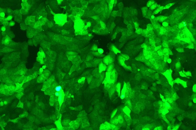 “高效穩(wěn)定，精準(zhǔn)轉(zhuǎn)染——尚恩生物慢病毒轉(zhuǎn)染服務(wù)全新登場！”