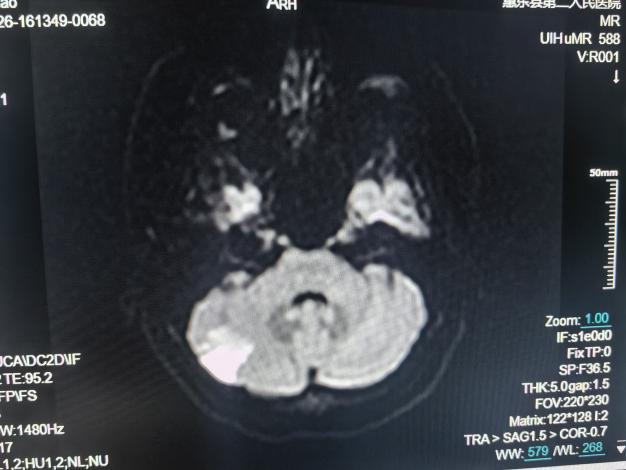 联影的磁共振怎么样号外！号外！！惠东县第二人民医院引进联影1.5T磁共振设备_https://www.jmylbn.com_新闻资讯_第7张