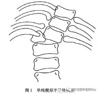 脊柱解剖的基本要点