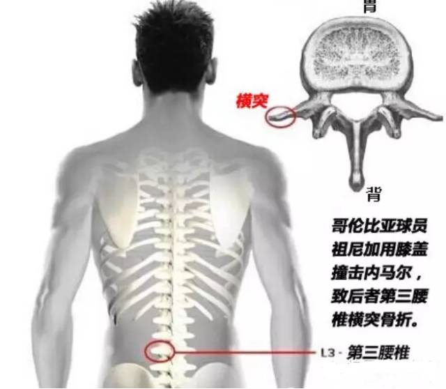 乾貨 | 腰腿痛診斷思維 健康 第7張