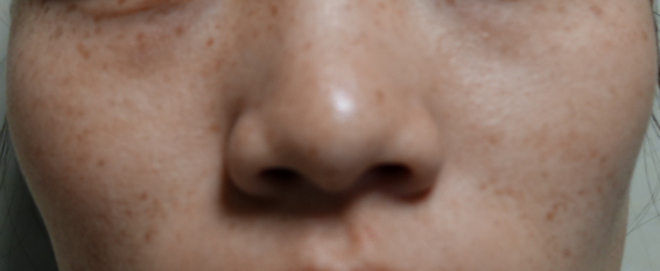 光子治疗仪有什么效果富医技术丨浅谈光子治疗_https://www.jmylbn.com_新闻资讯_第3张