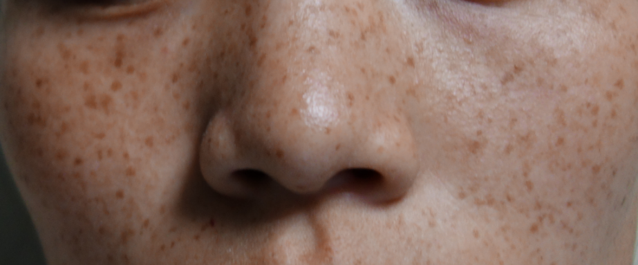 光子治疗仪有什么效果富医技术丨浅谈光子治疗_https://www.jmylbn.com_新闻资讯_第2张