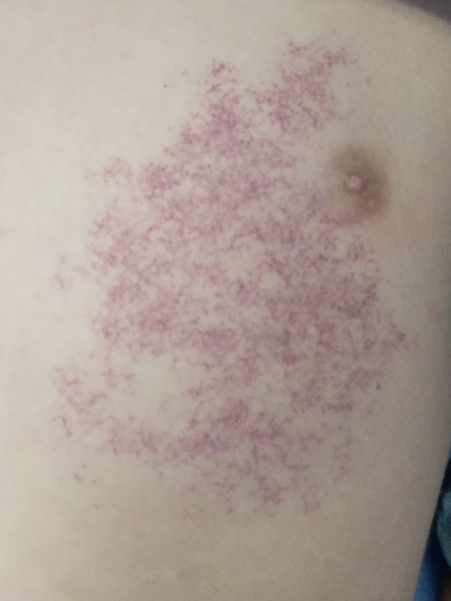 光子治疗仪有什么效果富医技术丨浅谈光子治疗_https://www.jmylbn.com_新闻资讯_第5张