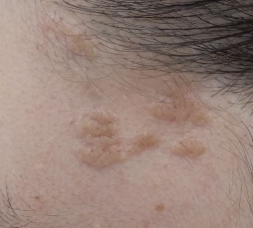 光子治疗仪有什么效果富医技术丨浅谈光子治疗_https://www.jmylbn.com_新闻资讯_第7张