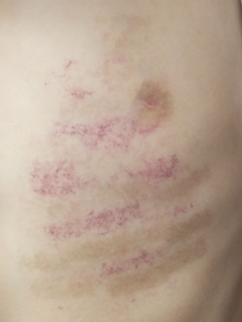 光子治疗仪有什么效果富医技术丨浅谈光子治疗_https://www.jmylbn.com_新闻资讯_第6张